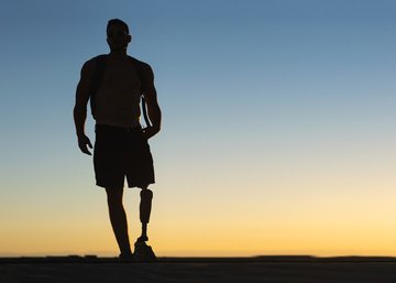 Prothèse fémorale Prothèse fémorale