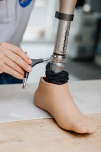 Prothésiste réglant l'adaptateur tube Ottobock AXON (REF 2R17) d'une prothèse de jambe. Pied prothétique beige et pylon gradué visible.